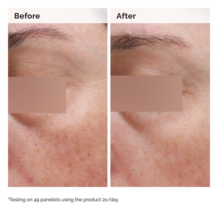 Niacinamide 5% Face and Body Emulsion - US 4160