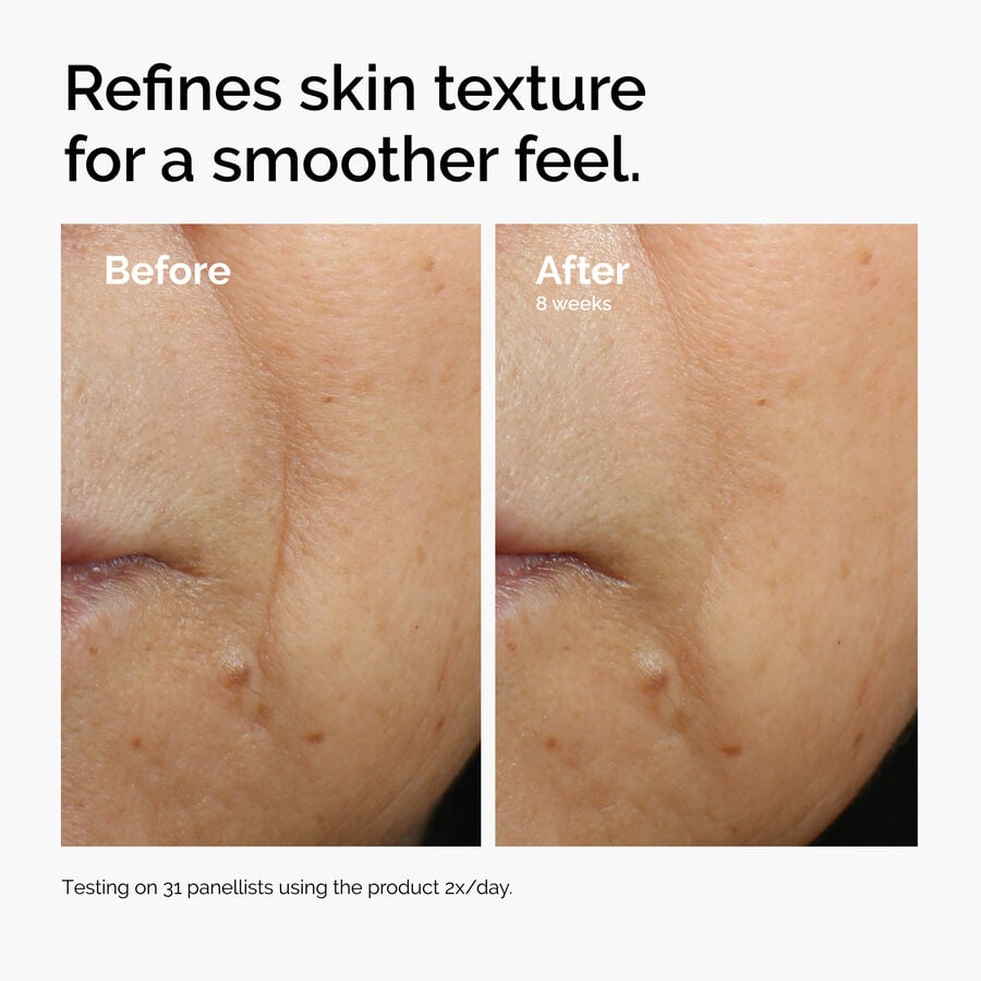 Caffeine 3% + Escin 1% Face Serum - US 3982