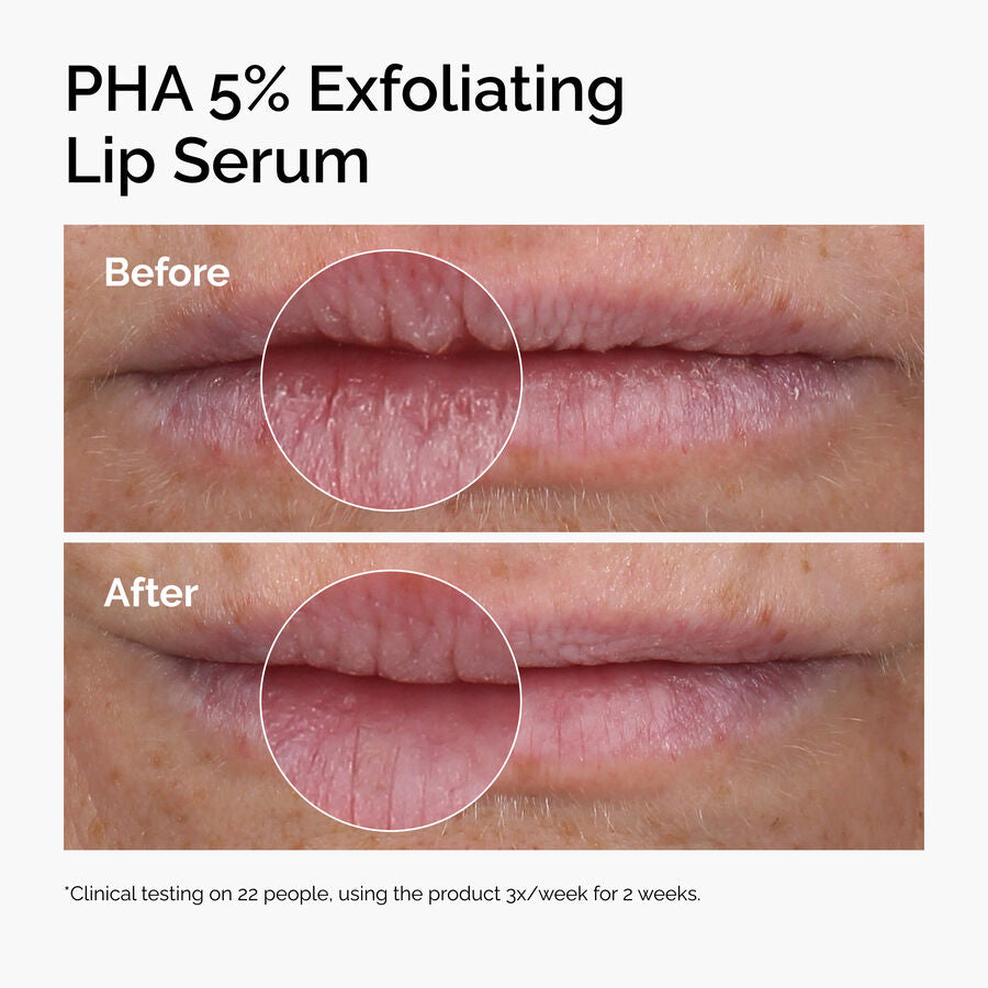PHA 5% Exfoliating Lip Serum - US 8328
