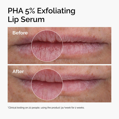 PHA 5% Exfoliating Lip Serum - US 8328